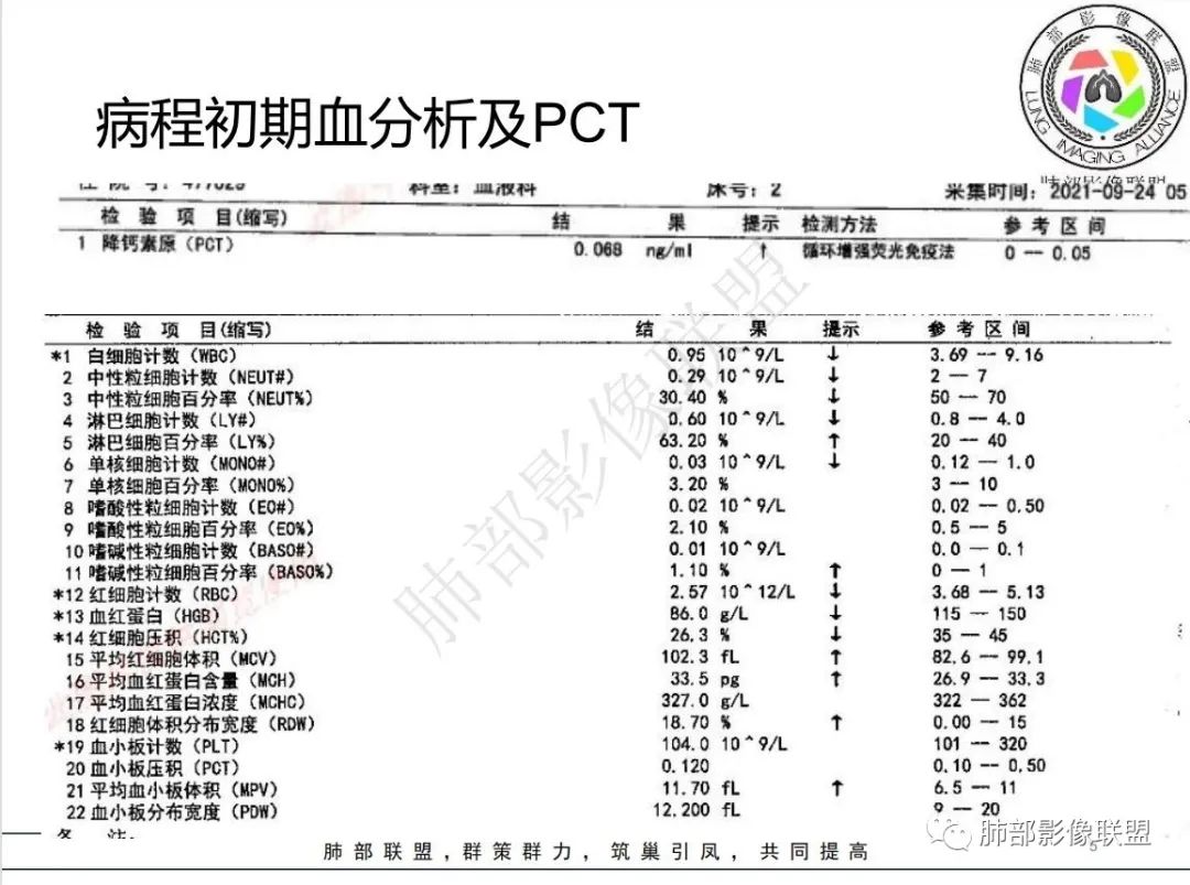 影像PPT - 【病例】白血病合并曲霉菌感染-5 影像PPT - 【病例】白血病合并曲霉菌感染-5