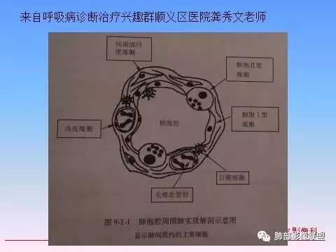 影像PPT - 白血病肺部病变读书笔记及实战-35 影像PPT - 白血病肺部病变读书笔记及实战-35