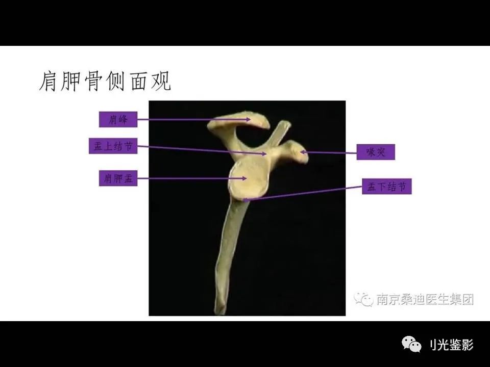 影像PPT - 【PPT】肩关节MRI-4 影像PPT - 【PPT】肩关节MRI-4