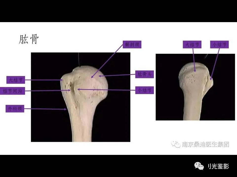 影像PPT - 【PPT】肩关节MRI-5 影像PPT - 【PPT】肩关节MRI-5