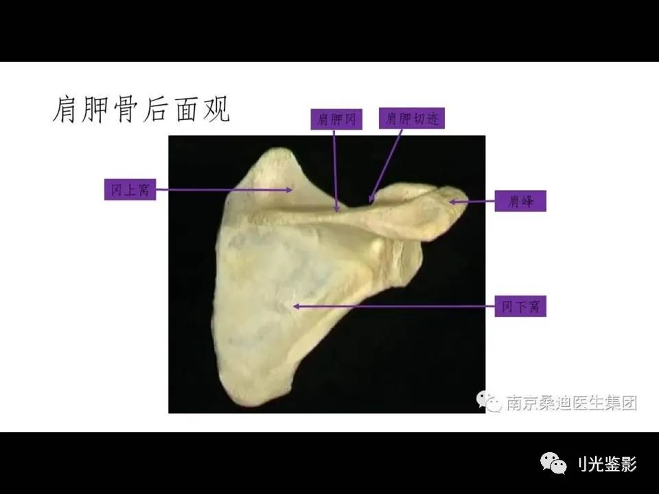 影像PPT - 【PPT】肩关节MRI-3 影像PPT - 【PPT】肩关节MRI-3