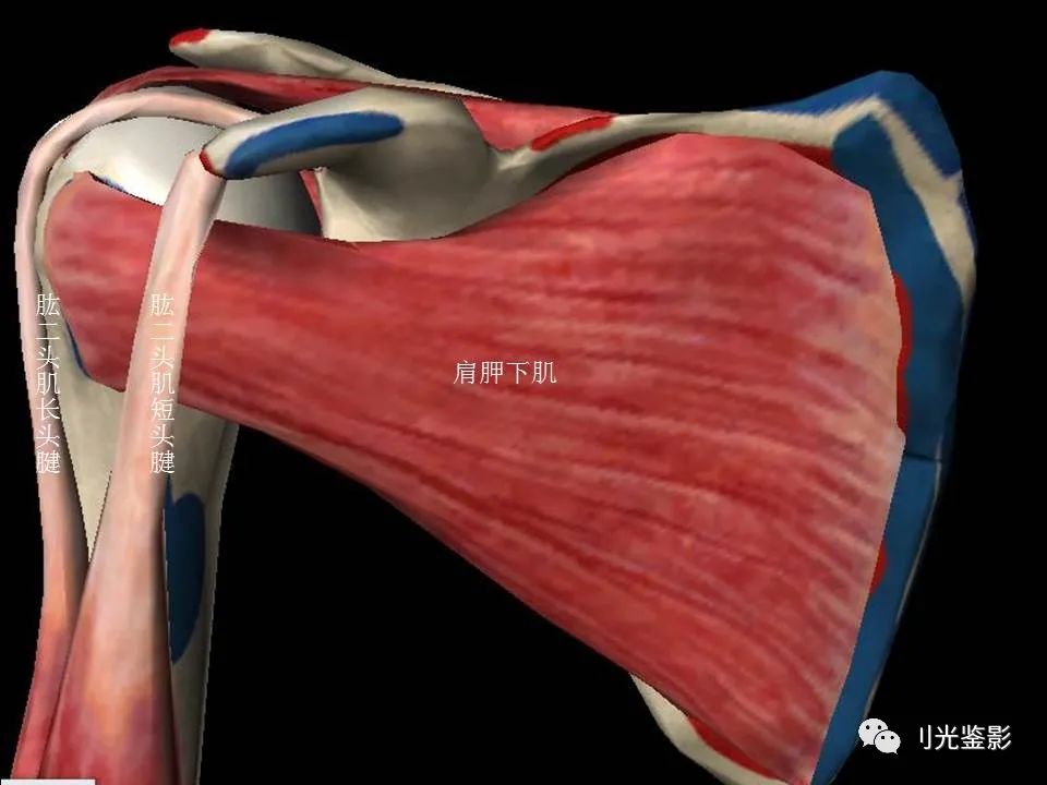 影像PPT - 【PPT】肩关节MRI-6 影像PPT - 【PPT】肩关节MRI-6