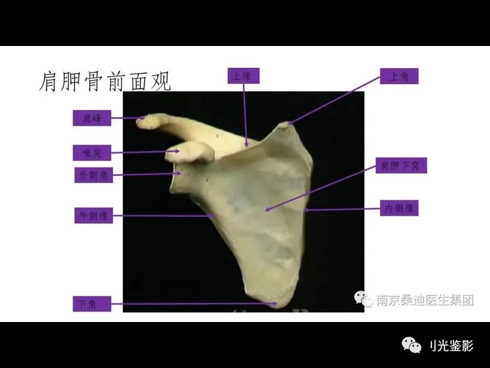 影像PPT - 【PPT】肩关节MRI-2 影像PPT - 【PPT】肩关节MRI-2