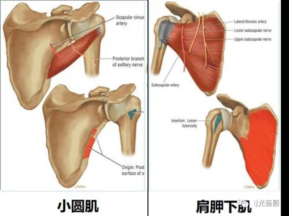 影像PPT - 【PPT】肩关节MRI-10 影像PPT - 【PPT】肩关节MRI-10