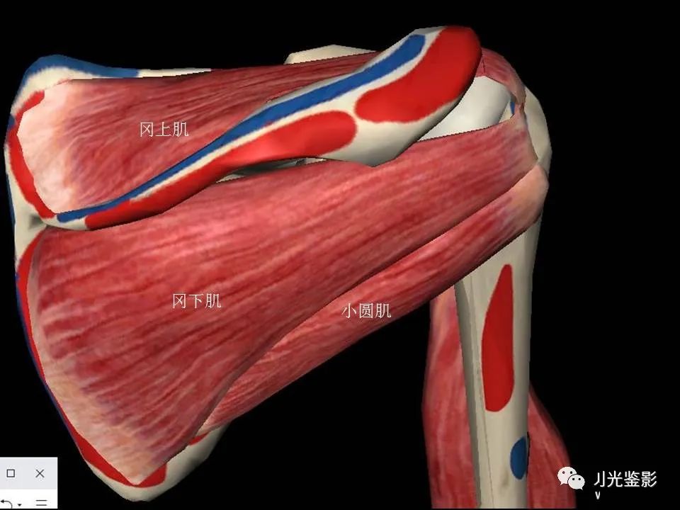 影像PPT - 【PPT】肩关节MRI-7 影像PPT - 【PPT】肩关节MRI-7
