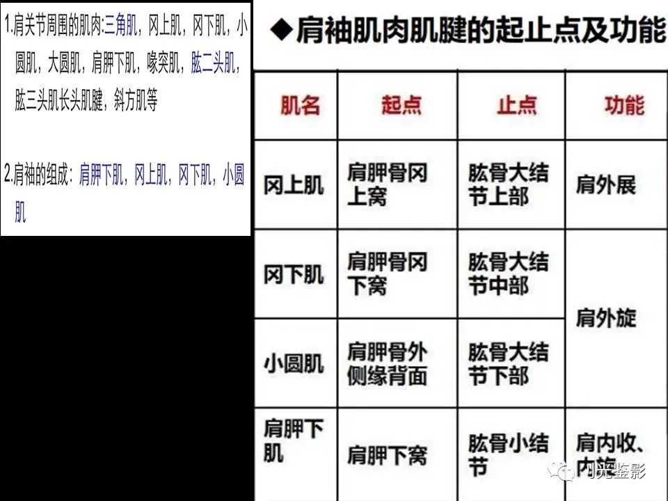 影像PPT - 【PPT】肩关节MRI-11 影像PPT - 【PPT】肩关节MRI-11