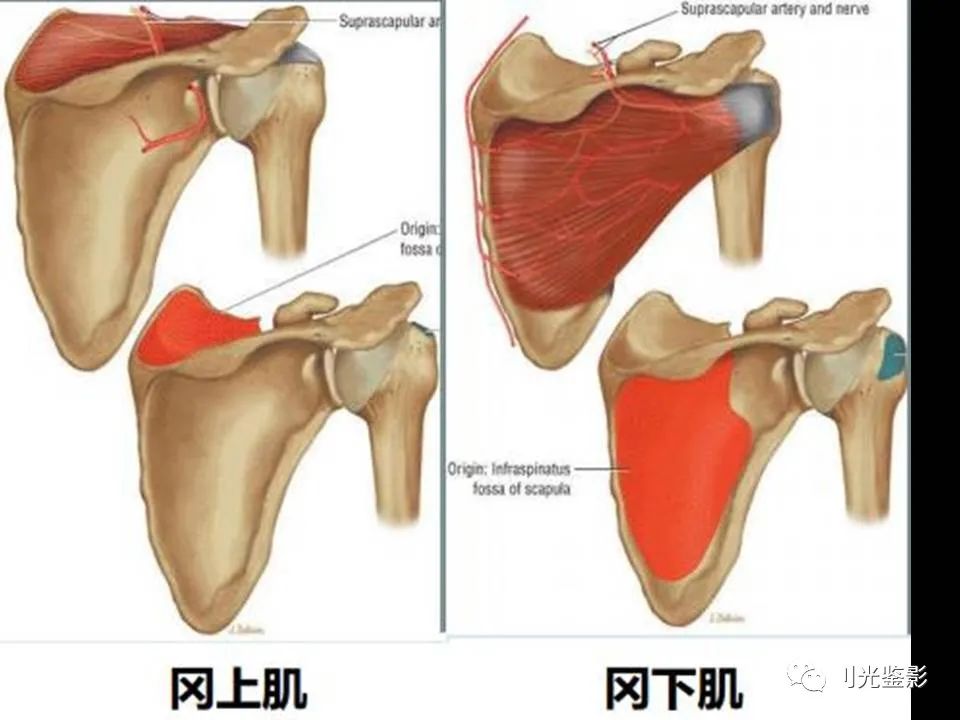 影像PPT - 【PPT】肩关节MRI-9 影像PPT - 【PPT】肩关节MRI-9