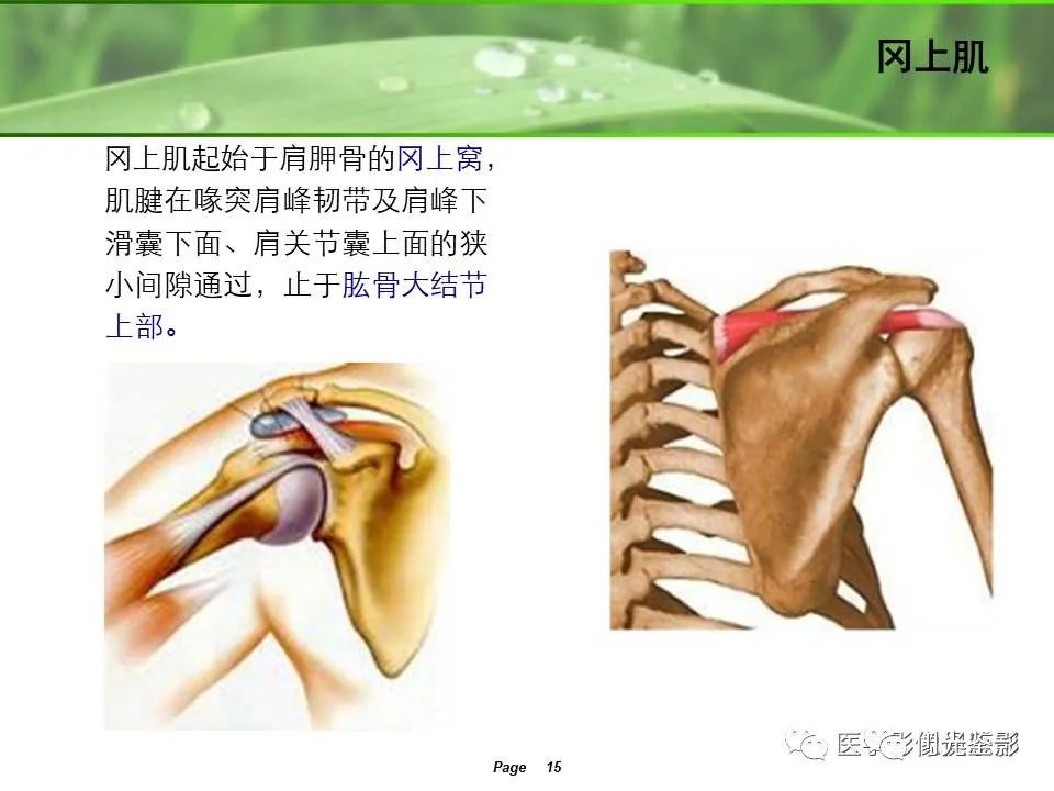 影像PPT - 【PPT】肩关节MRI-13 影像PPT - 【PPT】肩关节MRI-13