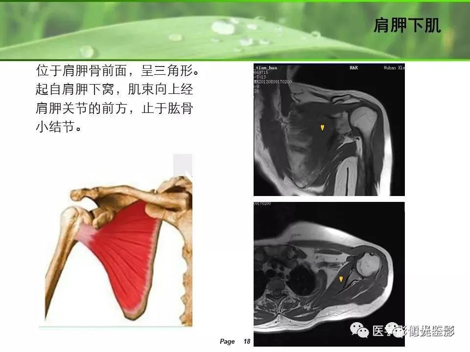 影像PPT - 【PPT】肩关节MRI-16 影像PPT - 【PPT】肩关节MRI-16