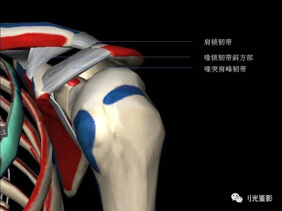影像PPT - 【PPT】肩关节MRI-18 影像PPT - 【PPT】肩关节MRI-18