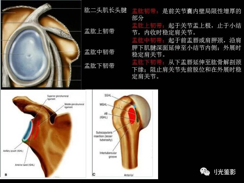 影像PPT - 【PPT】肩关节MRI-20 影像PPT - 【PPT】肩关节MRI-20