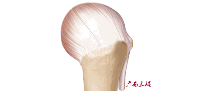 影像PPT - 【PPT】肩关节MRI-50 影像PPT - 【PPT】肩关节MRI-50