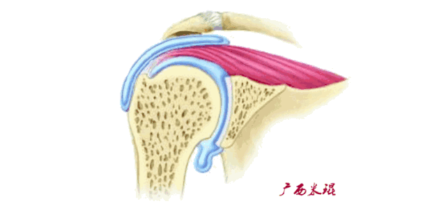 影像PPT - 【PPT】肩关节MRI-51 影像PPT - 【PPT】肩关节MRI-51