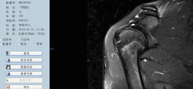 影像PPT - 【PPT】肩关节MRI-82 影像PPT - 【PPT】肩关节MRI-82