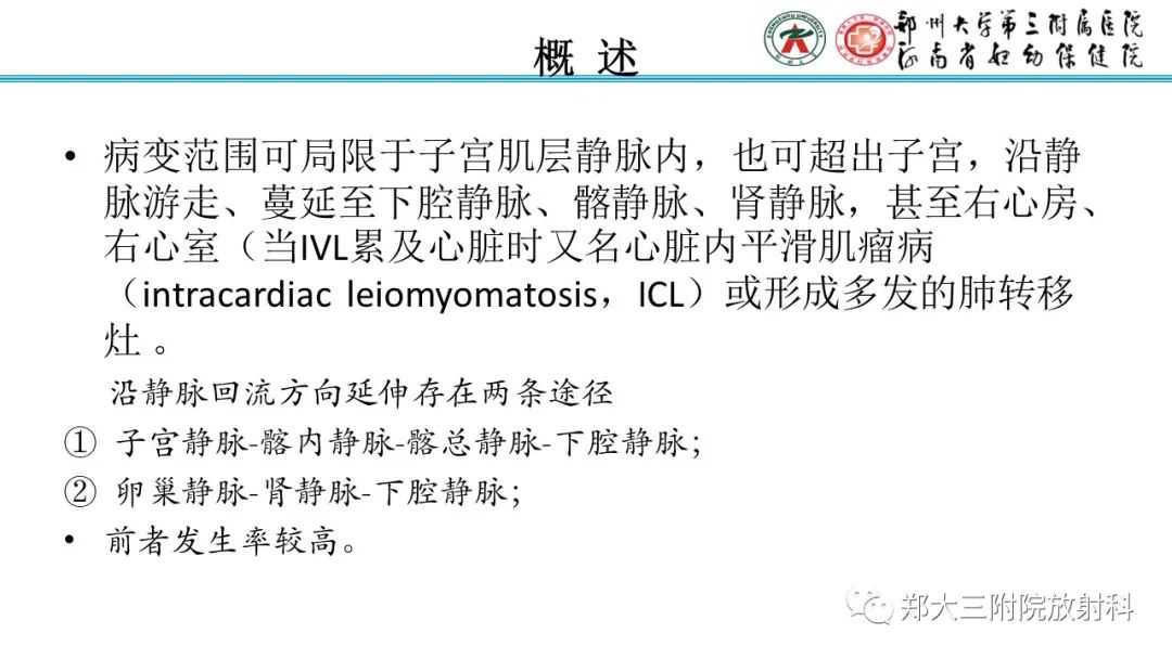 影像PPT - 【PPT】静脉内平滑肌瘤病的影像学诊断-9