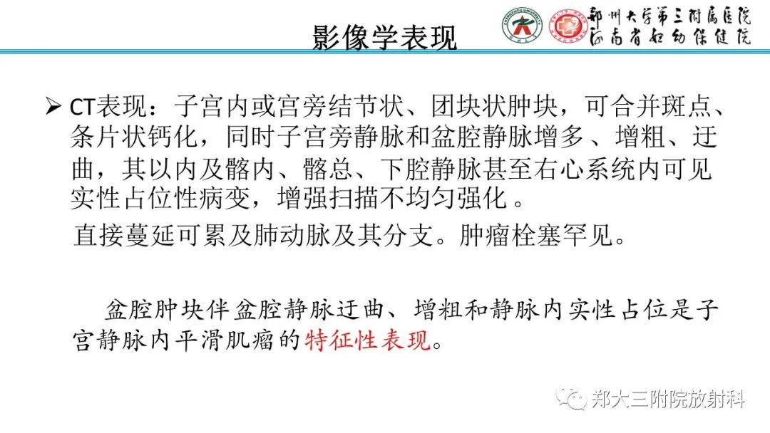 影像PPT - 【PPT】静脉内平滑肌瘤病的影像学诊断-16