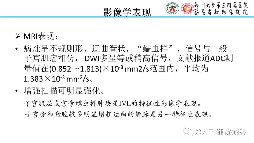 影像PPT - 【PPT】静脉内平滑肌瘤病的影像学诊断-17