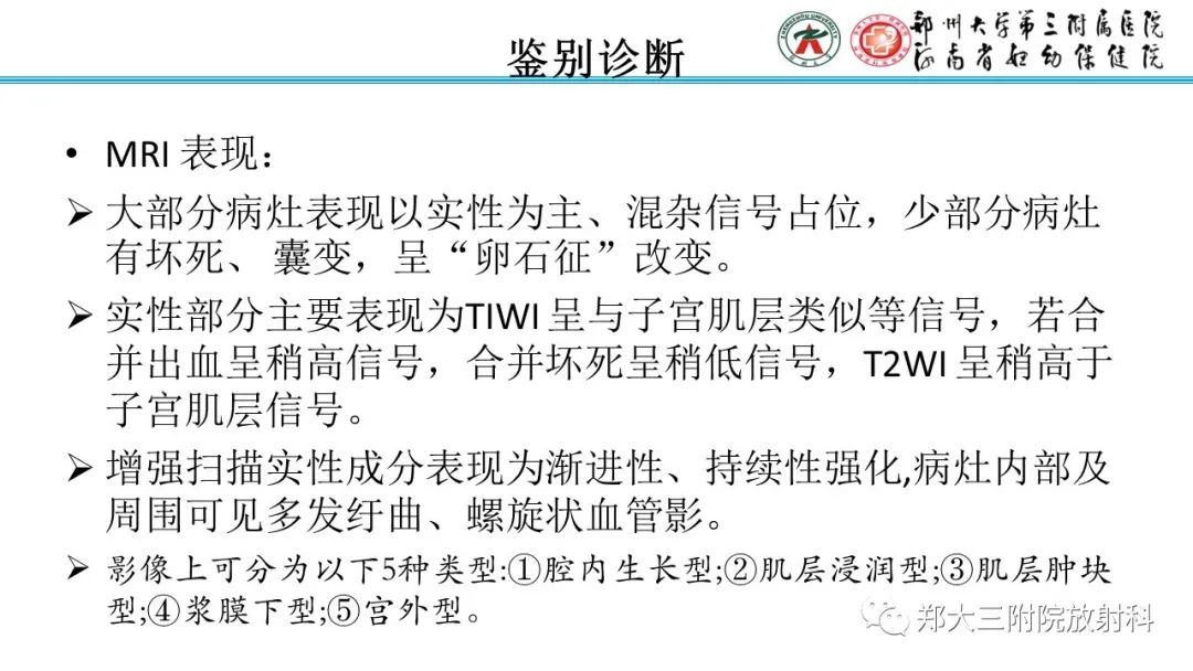 影像PPT - 【PPT】静脉内平滑肌瘤病的影像学诊断-22