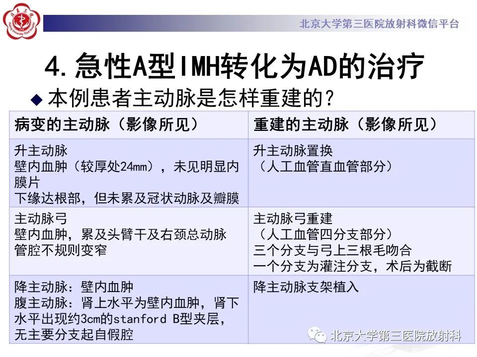 影像PPT - 【PPT】1例STANFORD A型主动脉壁内血肿转化夹层手术治影像学表现-31