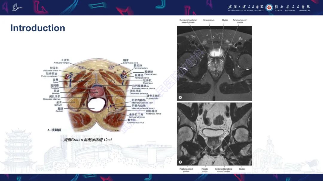 影像PPT - 【PPT】前列腺周围病变MRI诊断-5
