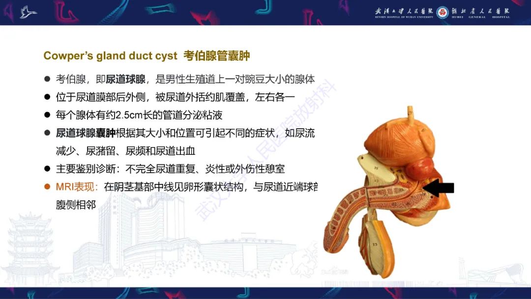 影像PPT - 【PPT】前列腺周围病变MRI诊断-19