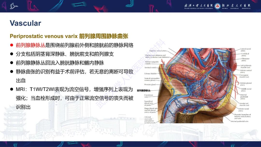 影像PPT - 【PPT】前列腺周围病变MRI诊断-57
