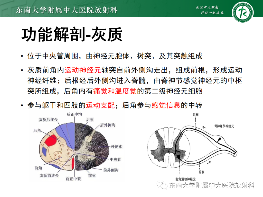 影像PPT - 【PPT】脊髓亚急性联合变性-7 影像PPT - 【PPT】脊髓亚急性联合变性-7