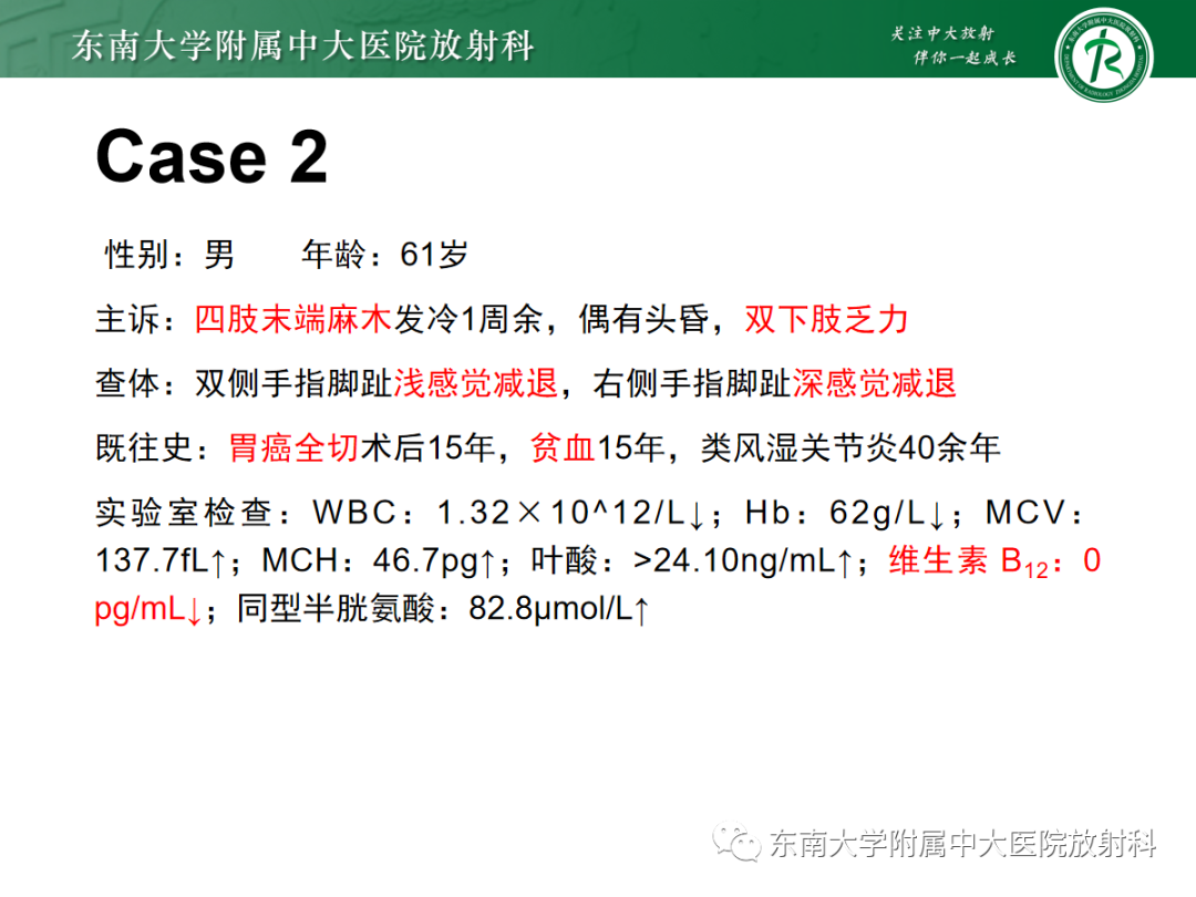 影像PPT - 【PPT】脊髓亚急性联合变性-15 影像PPT - 【PPT】脊髓亚急性联合变性-15