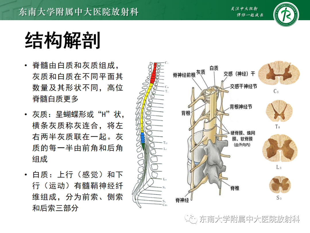 影像PPT - 【PPT】脊髓亚急性联合变性-6 影像PPT - 【PPT】脊髓亚急性联合变性-6