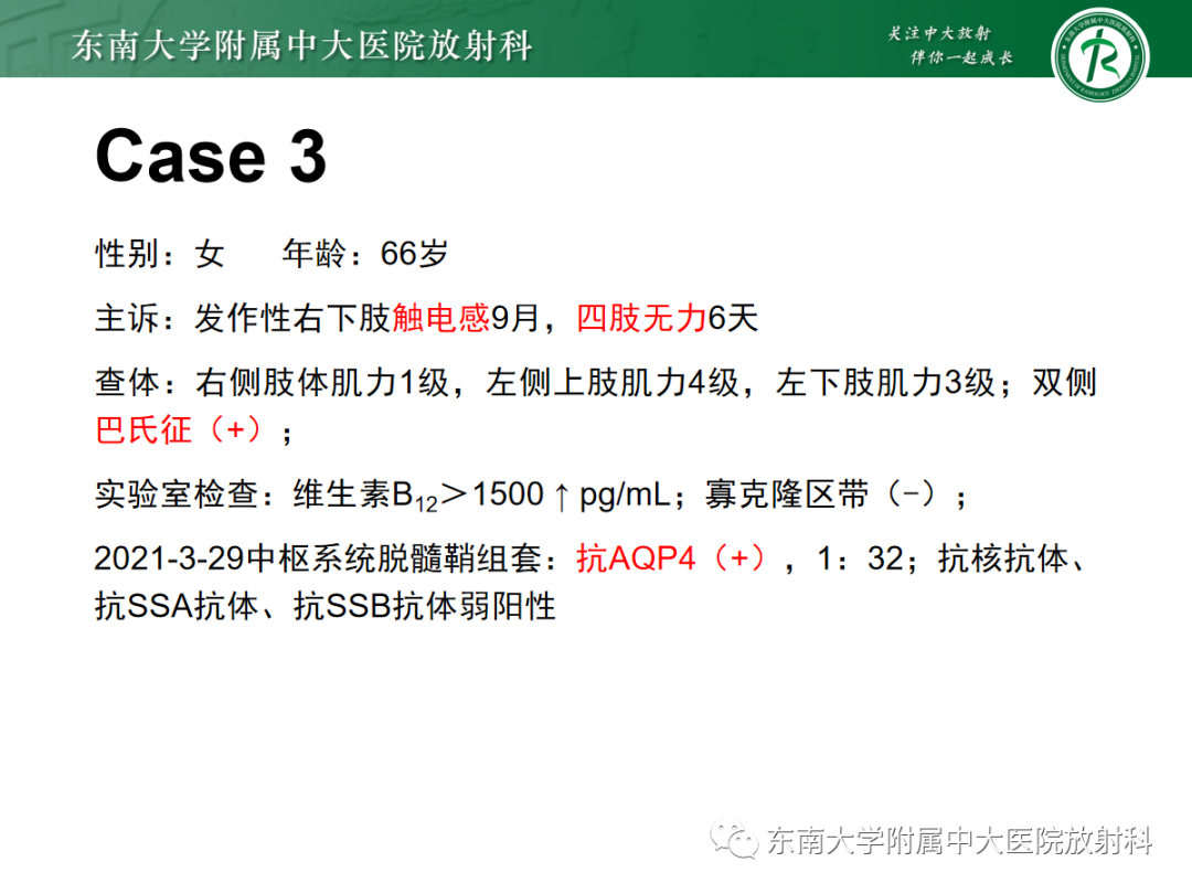 影像PPT - 【PPT】脊髓亚急性联合变性-22 影像PPT - 【PPT】脊髓亚急性联合变性-22