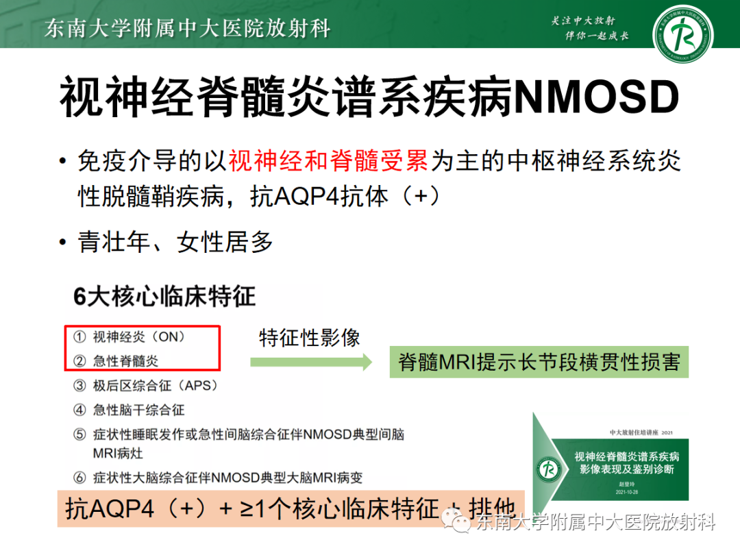 影像PPT - 【PPT】脊髓亚急性联合变性-18 影像PPT - 【PPT】脊髓亚急性联合变性-18