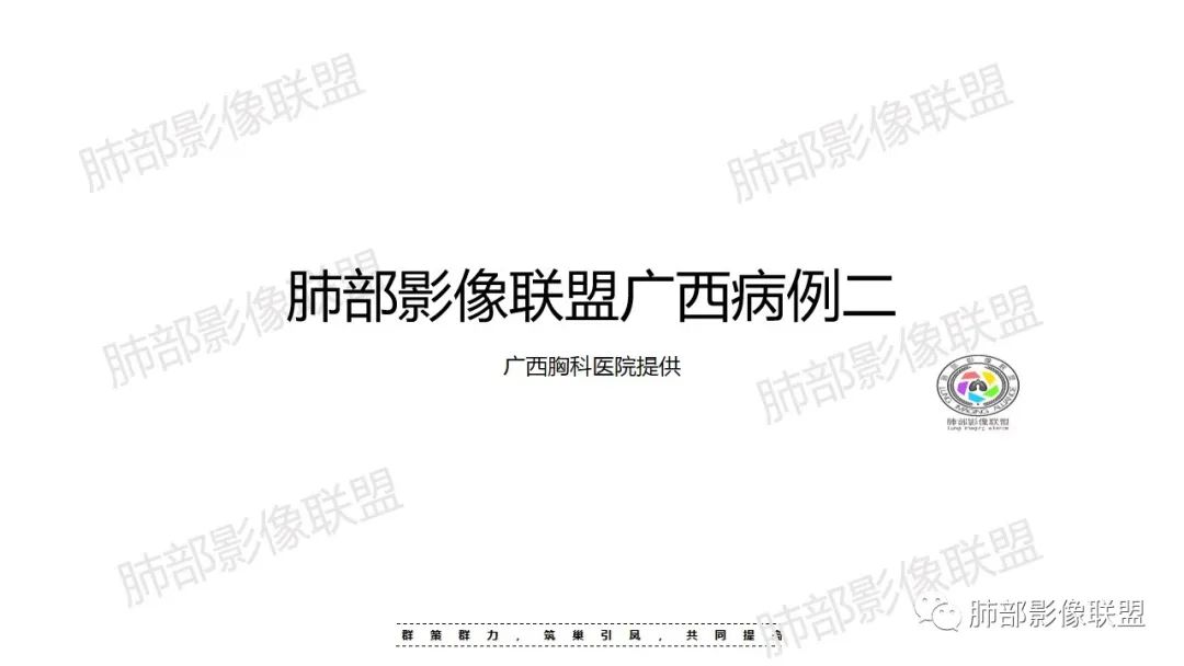 影像PPT - 【病例】影像经典之肺毛霉病-1 影像PPT - 【病例】影像经典之肺毛霉病-1