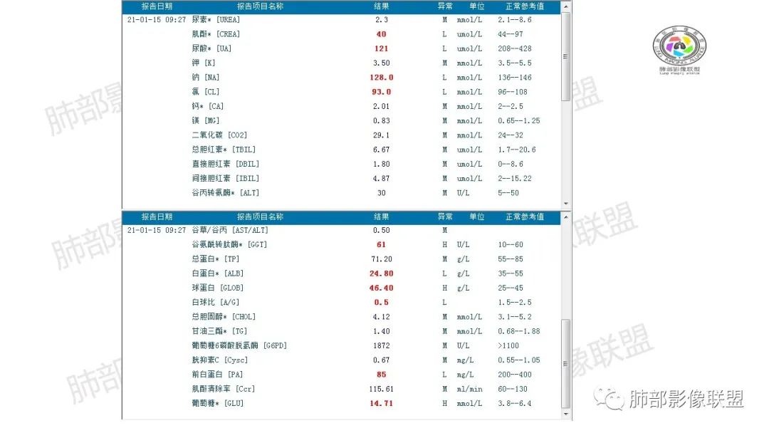 影像PPT - 【病例】影像经典之肺毛霉病-3 影像PPT - 【病例】影像经典之肺毛霉病-3