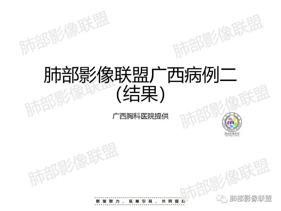 影像PPT - 【病例】影像经典之肺毛霉病-18 影像PPT - 【病例】影像经典之肺毛霉病-18