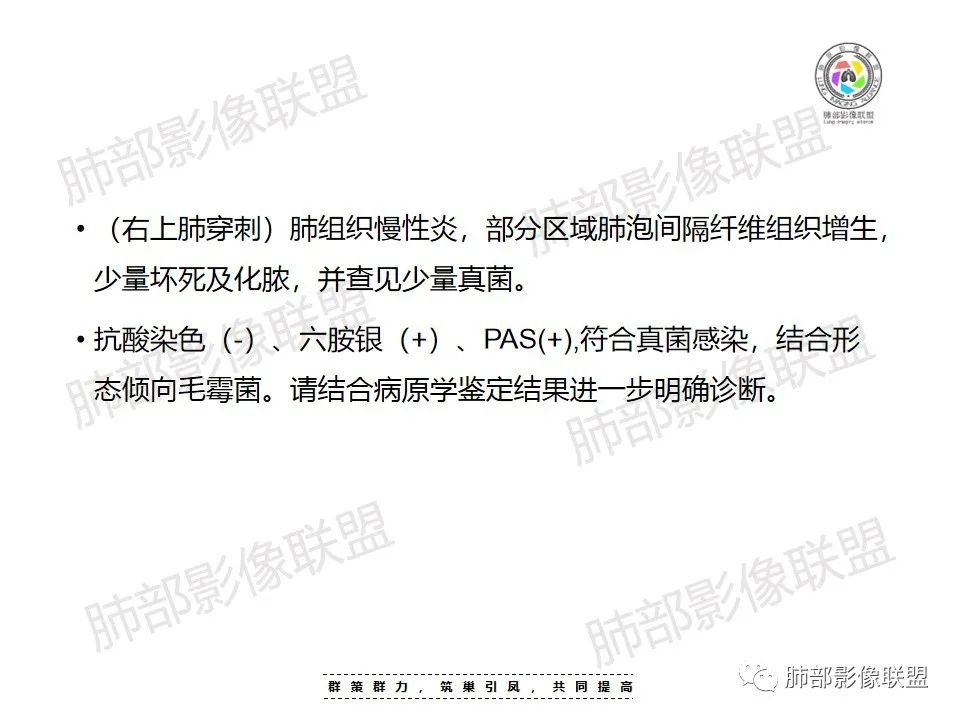 影像PPT - 【病例】影像经典之肺毛霉病-20 影像PPT - 【病例】影像经典之肺毛霉病-20