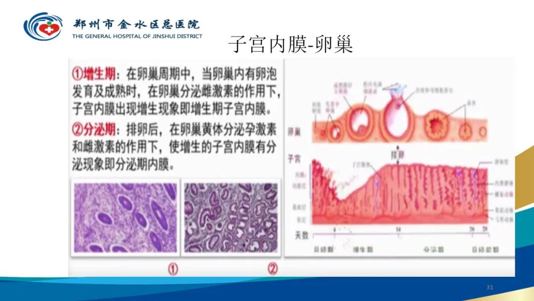 影像PPT - 【病例】巧克力囊肿-31