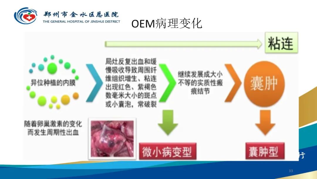 影像PPT - 【病例】巧克力囊肿-33