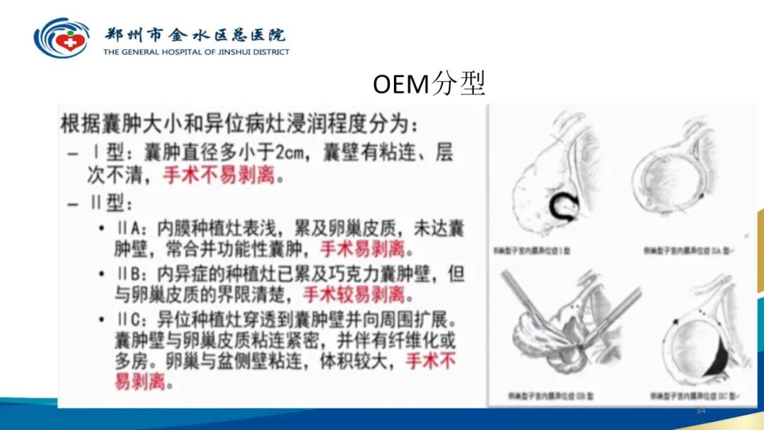 影像PPT - 【病例】巧克力囊肿-34