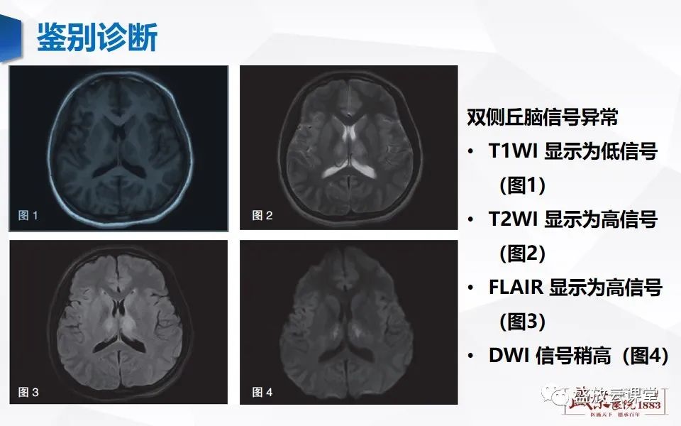 影像PPT - 【PPT】神经系统特殊感染（病毒性脑炎）-22
