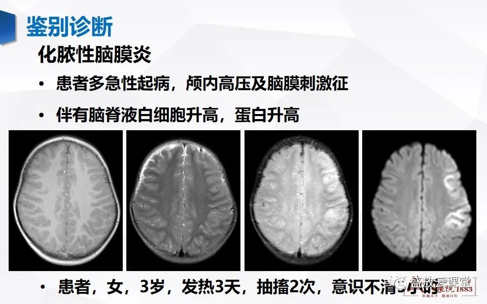 影像PPT - 【PPT】神经系统特殊感染（病毒性脑炎）-23