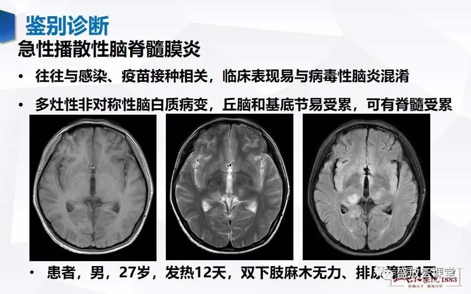 影像PPT - 【PPT】神经系统特殊感染（病毒性脑炎）-24