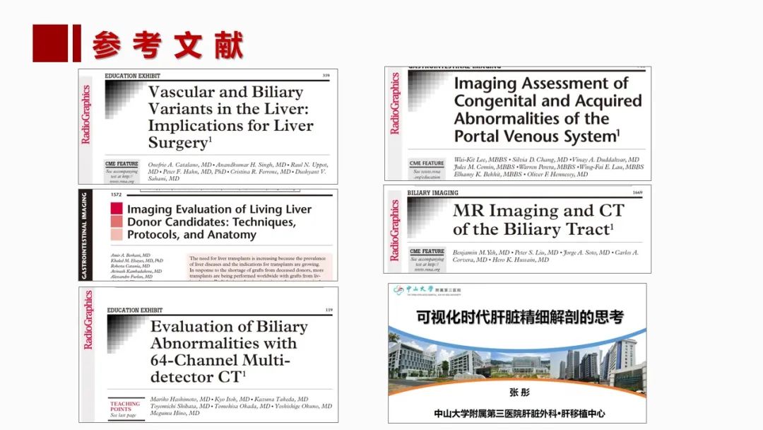 影像PPT - 【PPT】肝脏管道系统解剖变异影像评价-2
