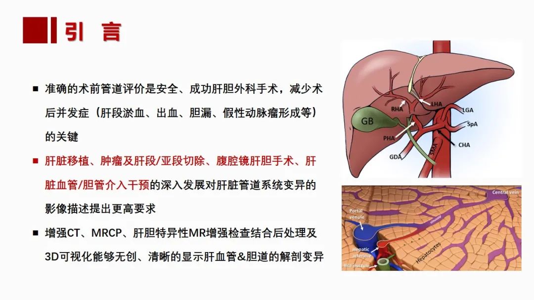 影像PPT - 【PPT】肝脏管道系统解剖变异影像评价-6