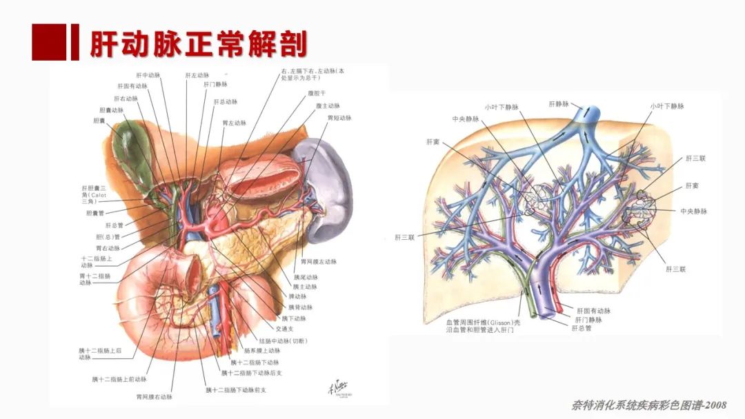 影像PPT - 【PPT】肝脏管道系统解剖变异影像评价-9
