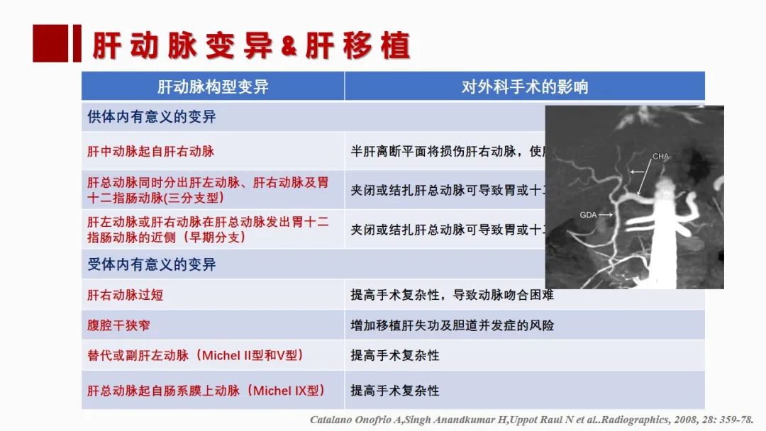影像PPT - 【PPT】肝脏管道系统解剖变异影像评价-18