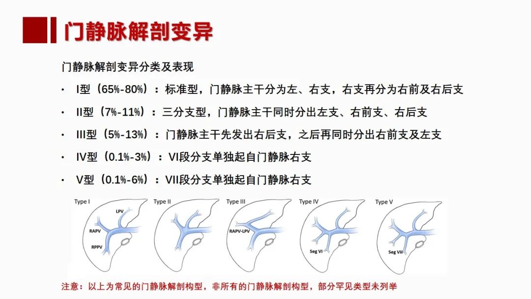影像PPT - 【PPT】肝脏管道系统解剖变异影像评价-23