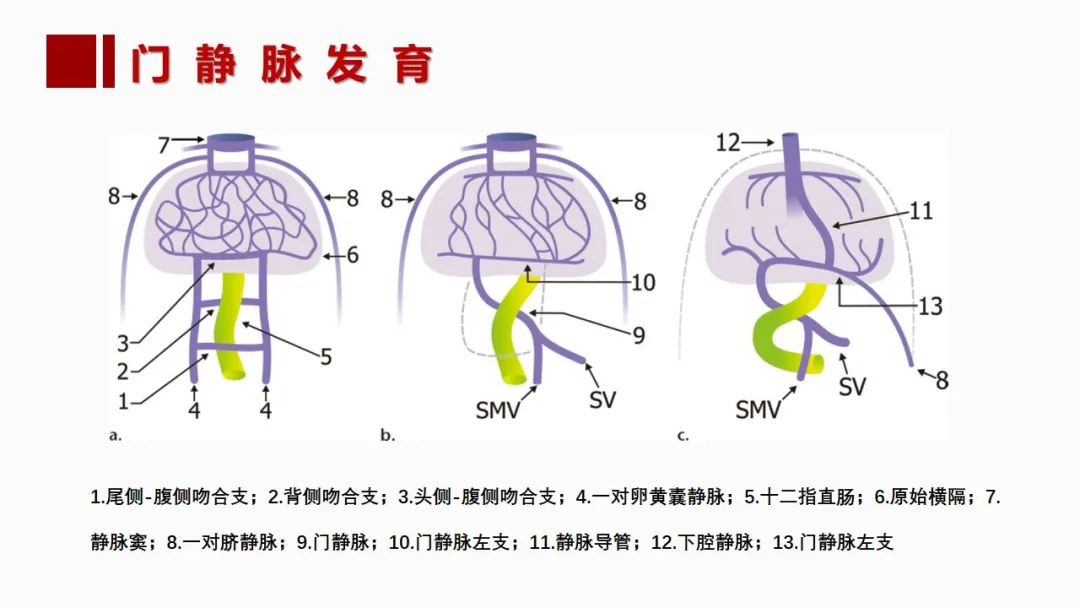 影像PPT - 【PPT】肝脏管道系统解剖变异影像评价-28