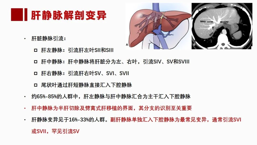 影像PPT - 【PPT】肝脏管道系统解剖变异影像评价-37