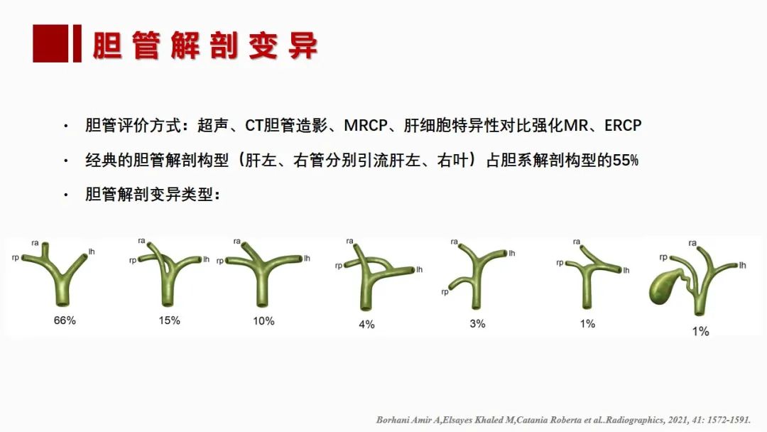 影像PPT - 【PPT】肝脏管道系统解剖变异影像评价-49