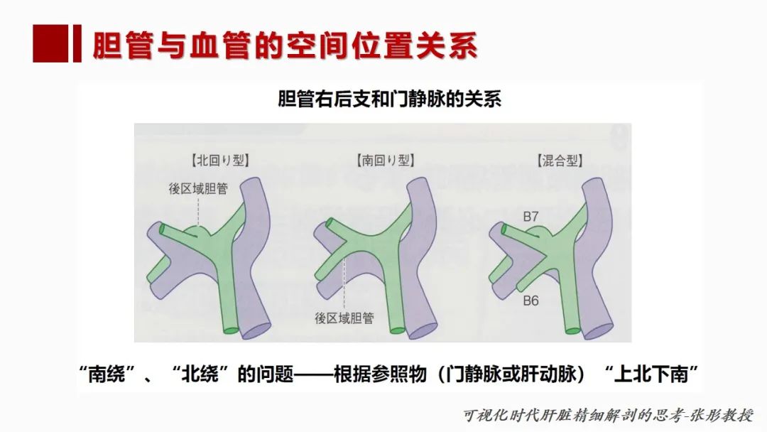 影像PPT - 【PPT】肝脏管道系统解剖变异影像评价-59
